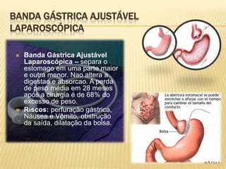 Banda GástricaAjustávelLaparoscópicaBanda GástricaAjustávelLaparoscópica – separa o estomagoemuma parte maior e outramenor. Nao altera a digestao e absorcao. A perda de peso média em 28 meses após a cirurgia é de 68% do excesso de peso.Riscos: perfuração gástrica, Náusea e Vômito, obstrução da saída, dilatação da bolsa.