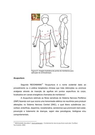 Figura 01: Imagem ilustrativa de pontos de meridianos para
aplicação da ventosaterapia.
Acupuntura
Segundo REICKMANN17
“Acupuntura é o nome ocidental dado ao
procedimento ou à prática terapêutica chinesa que trata disfunções ou promove
analgesia através da inserção de agulhas em pontos específicos do corpo,
localizados em canais energéticos chamados de meridianos”.
A Acupuntura estimula as fibras sensitivas do Sistema Nervoso Periférico
(SNP) fazendo com que ocorra uma transmissão elétrica via neurônios para produzir
alterações no Sistema Nervoso Central (SNC), o qual libera substâncias (ex.:
cortisol, endorfinas, dopamina, noradrenalina, serotonina) que promovem bem-estar,
prevenção e tratamento de doenças, sejam elas psicológicas, biológicas e/ou
comportamentais.
17
REICKMANN, Brunilda T. Auriculoterapia – Fundamentos de acupuntura auricular. Curitiba:
Tecnodata, 2002
 