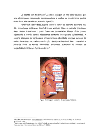 De acordo com Reickmann19
, pode-se dissipar um mal estar causado por
uma alimentação inadequada massageando-se a orelha ou pressionando pontos
específicos relacionados ao aparelho digestório.
Para tratar a obesidade, sugere-se sedar pontos do aparelho digestório (fig.
03), como boca, estômago, baço/pâncreas, vesícula biliar, e estimular intestinos.
Além destes, trabalha-se o ponto Shen Men (ansiedade), Hunger Point (fome),
hipotálamo e outros pontos necessários conforme desequilíbrio apresentado. A
escolha adequada de pontos para o tratamento da obesidade promove aumento do
metabolismo corporal, melhora na função digestiva e intestinal, bem como efeitos
positivos sobre os fatores emocionais envolvidos, auxiliando no controle da
compulsão alimentar, de forma saudável.20
Figura 03: Imagem ilustrativa de pontos auriculares.
19 REICKMANN, Brunilda T. Auriculoterapia – Fundamentos de acupuntura auricular.p 26. Curitiba:
Tecnodata, 2002.
20
JM Lacey1, AM Tershakovec2 and GD Foster2. Acupuncture for the treatment of obesity: a review of
the evidence. International Journal of Obesity (2003).
 