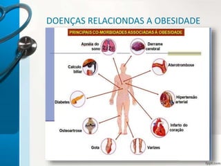 DOENÇAS RELACIONDAS A OBESIDADE
 