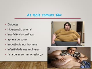 As mais comuns são:
• Diabetes
• hipertensão arterial
• insuficiência cardíaca
• apnéia do sono
• impotência nos homens
• infertilidade nas mulheres
• falta de ar ao menor esforço
 