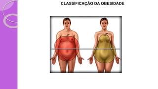 CLASSIFICAÇÃO DA OBESIDADE
 