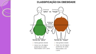 CLASSIFICAÇÃO DA OBESIDADE
 