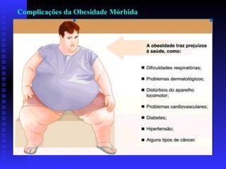 Complicações da Obesidade Mórbida 
