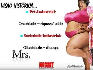 VISÃO HISTÓRICA...
Pré-Industrial:
Obesidade = riqueza/saúde
Sociedade Industrial:
Obesidade = doença