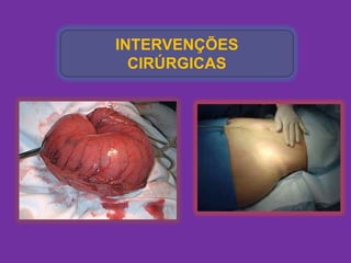 INTERVENÇÕES
  CIRÚRGICAS
 