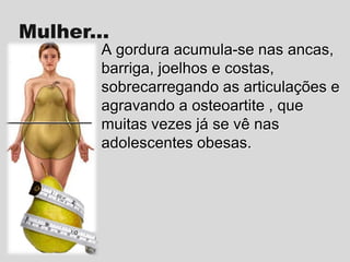 Mulher...
A gordura acumula-se nas ancas,
barriga, joelhos e costas,
sobrecarregando as articulações e
agravando a osteoartite , que
muitas vezes já se vê nas
adolescentes obesas.

 