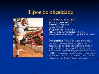 LUIZ ROTTA FILHO 62 anos, comerciante  Altura:  1,70 metro Peso:  83 quilos  Triglicérides:  390 mg/dl  HDL (colesterol bom):  32 mg/dl  Pressão arterial:  entre 12 por 8 e 15 por 9  Comentário:  Rotta Filho não pertence à categoria dos obesos, mas apresenta depósito de gordura predominantemente abdominal – o que se reflete nos níveis elevados de triglicérides, nas baixas taxas de HDL, o colesterol bom, e nos episódios de hipertensão arterial. É grande o risco de ele sofrer de problemas cardiovasculares  Tipos de obesidade   