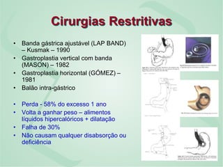 Cirurgias Restritivas
• Banda gástrica ajustável (LAP BAND)
– Kusmak – 1990
• Gastroplastia vertical com banda
(MASON) – 1982
• Gastroplastia horizontal (GÓMEZ) –
1981
• Balão intra-gástrico
• Perda - 58% do excesso 1 ano
• Volta a ganhar peso – alimentos
líquidos hipercalóricos + dilatação
• Falha de 30%
• Não causam qualquer disabsorção ou
deficiência
 