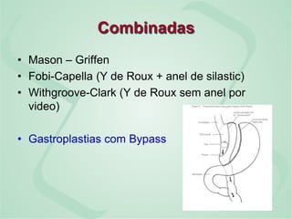 Combinadas
• Mason – Griffen
• Fobi-Capella (Y de Roux + anel de silastic)
• Withgroove-Clark (Y de Roux sem anel por
video)
• Gastroplastias com Bypass
 