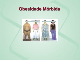 Obesidade Mórbida
 