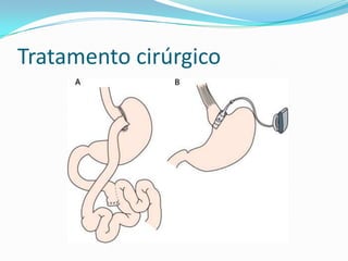 Tratamento cirúrgico
 