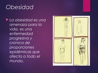 Obesidad
 La obesidad es una
amenaza para la
vida, es una
enfermedad
progresiva y
crónica de
proporciones
epidémicas que
afecta a todo el
mundo.
 