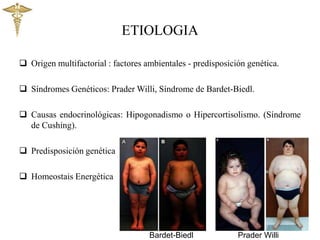 ETIOLOGIA
 Origen multifactorial : factores ambientales - predisposición genética.
 Síndromes Genéticos: Prader Willi, Síndrome de Bardet-Biedl.
 Causas endocrinológicas: Hipogonadismo o Hipercortisolismo. (Síndrome
de Cushing).
 Predisposición genética
 Homeostais Energética
Bardet-Biedl Prader Willi
 