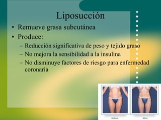 Liposucción Remueve grasa subcutánea Produce: Reducción significativa de peso y tejido graso No mejora la sensibilidad a la insulina No disminuye factores de riesgo para enfermedad coronaria 