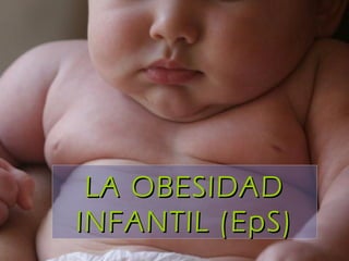 LA OBESIDAD INFANTIL (EpS) 