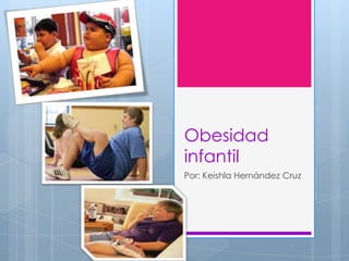 Obesidad
infantil
Por: Keishla Hernández Cruz
 