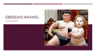 OBESIDAD INFANTIL.
COMO EVITARLA.
 
