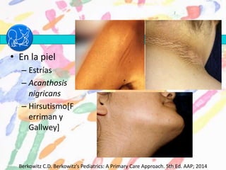 • En la piel
– Estrías
– Acanthosis
nigricans
– Hirsutismo[F
erriman y
Gallwey]
Berkowitz C.D. Berkowitz’s Pediatrics: A Primary Care Approach. 5th Ed. AAP; 2014
 