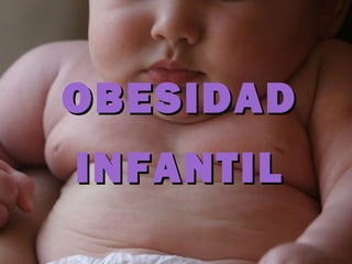 OBESIDAD
INFANTIL
 