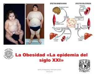 La Obesidad «La epidemia del
siglo XXI»
MPSS HERNANDEZ PARTIDA JORGE
EZEQUIEL
 