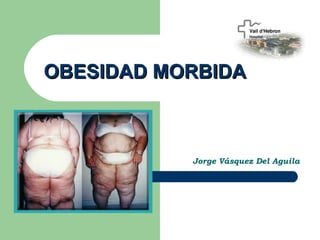 OBESIDAD MORBIDA



           Jorge Vásquez Del Aguila
 
