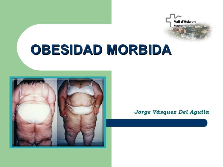 Aspectos Básicos Del Tratamiento Quirúrgico De La Obesidad - 