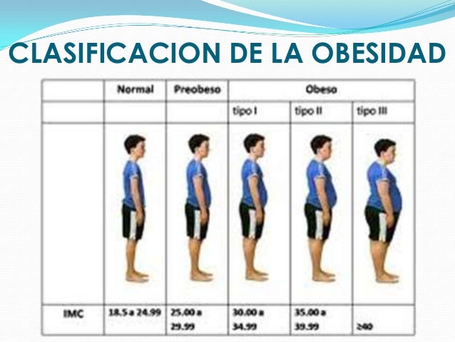 Obesidad Obesidad