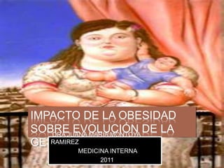 IMPACTO DE LA OBESIDAD
SOBRE EVOLUCIÓN DE LA
GESTACIÓN.
DRA JUANA MARIA MONTOYA
RAMIREZ
MEDICINA INTERNA
2011
 