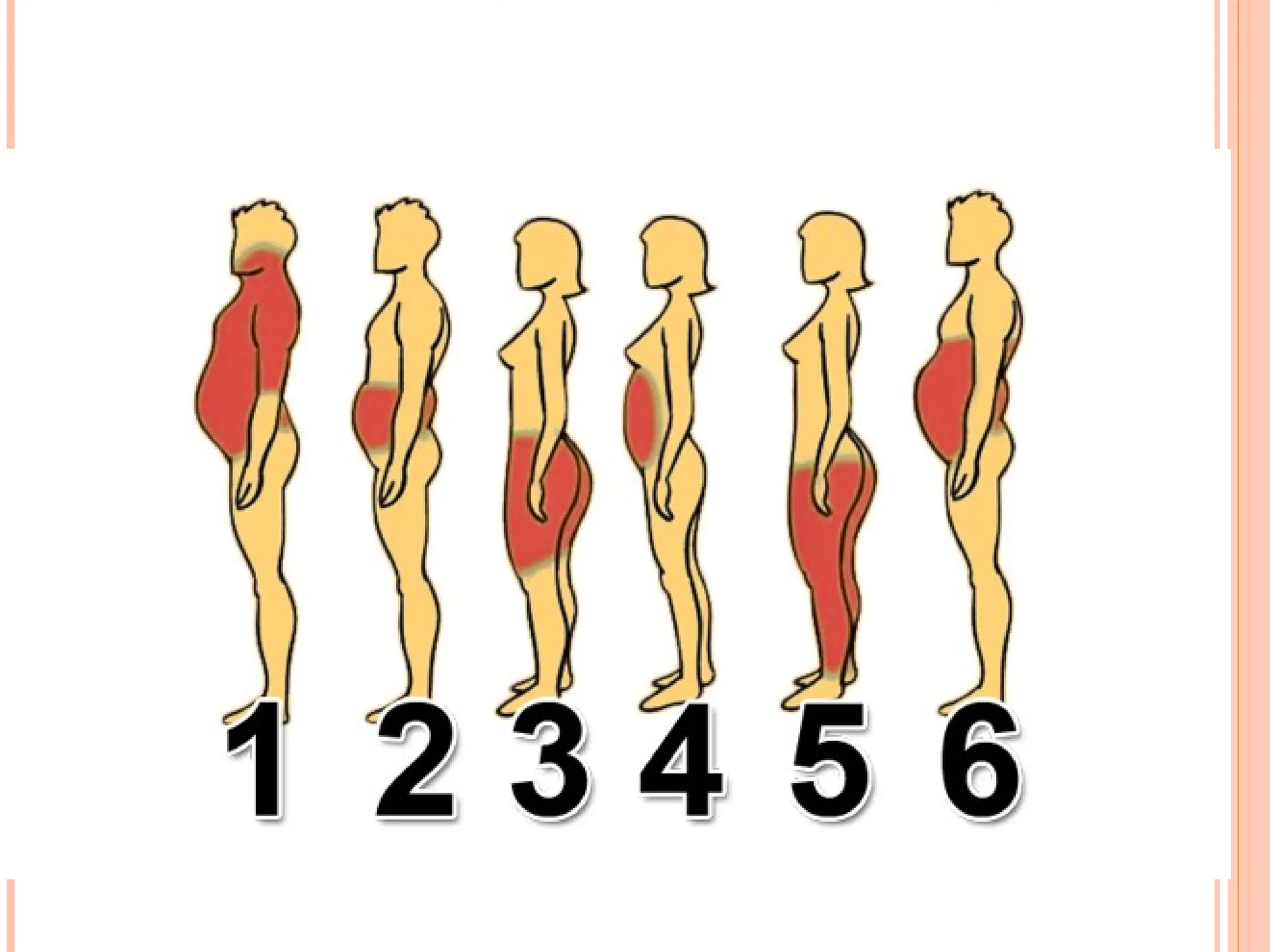 Tanda Dan Bahaya Obesitas Atau Kegemukan Ppt