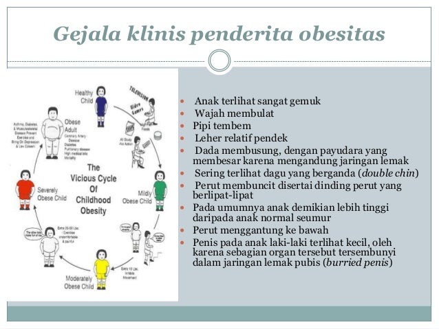Obesitas pada anak