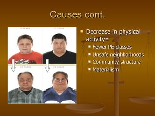 Causes cont. Decrease in physical activity= Fewer PE classes Unsafe neighborhoods Community structure Materialism 