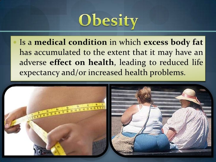 Obesity Oral Presentation 3TERM