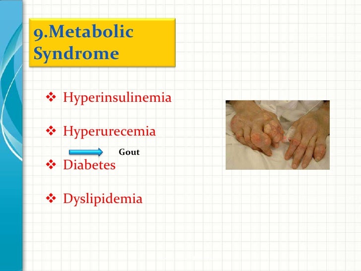 Obesity- Metabolic alterations complications and treatment