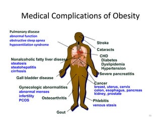 Medical Complications of Obesity
Pulmonary disease
abnormal function
obstructive sleep apnea
hypoventilation syndrome             Stroke
                                     Cataracts
                                      CHD
Nonalcoholic fatty liver disease       Diabetes
steatosis                              Dyslipidemia
steatohepatitis                        Hypertension
cirrhosis
                                      Severe pancreatitis
    Gall bladder disease
                                   Cancer
     Gynecologic abnormalities     breast, uterus, cervix
     abnormal menses               colon, esophagus, pancreas
                                   kidney, prostate
     infertility
                 Osteoarthritis
     PCOS                          Phlebitis
                                   venous stasis

                           Gout
                                                                16
 