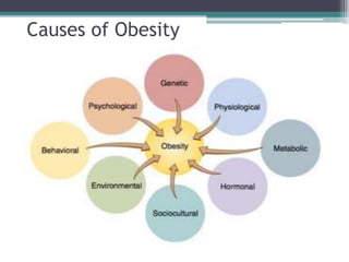 Causes of Obesity
 