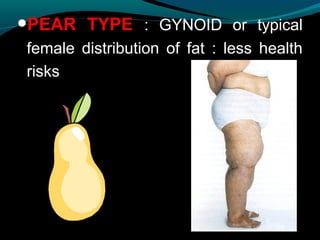 •PEAR TYPE : GYNOID or typical
female distribution of fat : less health
risks
 