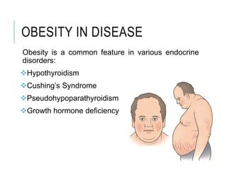 OBESITY IN DISEASE
Obesity is a common feature in various endocrine
disorders:
Hypothyroidism
Cushing’s Syndrome
Pseudohypoparathyroidism
Growth hormone deficiency
 