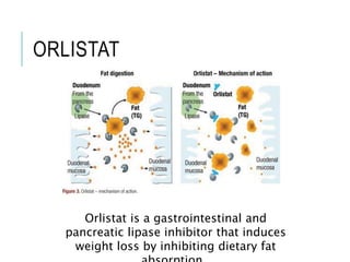 ORLISTAT
Orlistat is a gastrointestinal and
pancreatic lipase inhibitor that induces
weight loss by inhibiting dietary fat
 