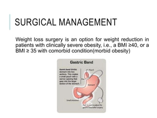 SURGICAL MANAGEMENT
Weight loss surgery is an option for weight reduction in
patients with clinically severe obesity, i.e., a BMI ≥40, or a
BMI ≥ 35 with comorbid condition(morbid obesity)
 