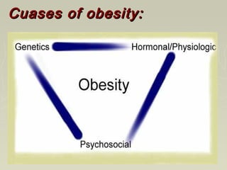 Cuases of obesity:Cuases of obesity:
 