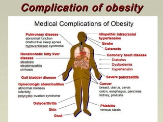 Complication of obesityComplication of obesity
 