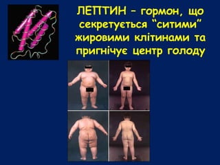 ЛЕПТИН – гормон, що
секретується “ситими”
жировими клітинами та
пригнічує центр голоду
 