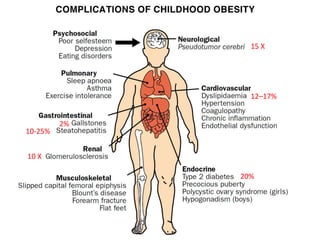 12–17%
10 X
10-25%
2%
15 X
20%
 