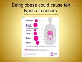 Being obese could cause ten
types of cancers.
 