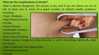What are the complications of obesity?
Now is obesity dangerous, the answer is yes, and if you are obese you are at
risk t...