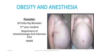 OBESITY AND ANESTHESIA
Presenter:
Dr.Tirtha Raj Bhandari
2nd year resident
Department of
Anesthesiology And Intensive
Care
NAMS
2/23/2019 Department of Anesthesiology and Intensive Care 1
 