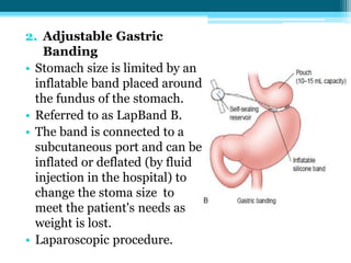 2. Adjustable Gastric
Banding
• Stomach size is limited by an
inflatable band placed around
the fundus of the stomach.
• Referred to as LapBand B.
• The band is connected to a
subcutaneous port and can be
inflated or deflated (by fluid
injection in the hospital) to
change the stoma size to
meet the patient's needs as
weight is lost.
• Laparoscopic procedure.
 