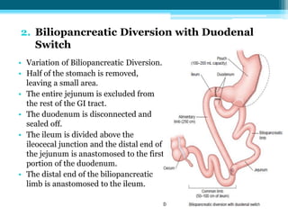 2. Biliopancreatic Diversion with Duodenal
Switch
• Variation of Biliopancreatic Diversion.
• Half of the stomach is removed,
leaving a small area.
• The entire jejunum is excluded from
the rest of the GI tract.
• The duodenum is disconnected and
sealed off.
• The ileum is divided above the
ileocecal junction and the distal end of
the jejunum is anastomosed to the first
portion of the duodenum.
• The distal end of the biliopancreatic
limb is anastomosed to the ileum.
 