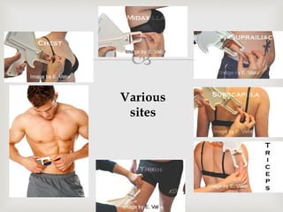 
 Abdomen
 Thigh
Various
sites
 